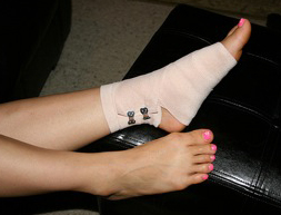 Wrap a sprained ankle