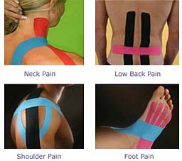 Kinesiology Tape